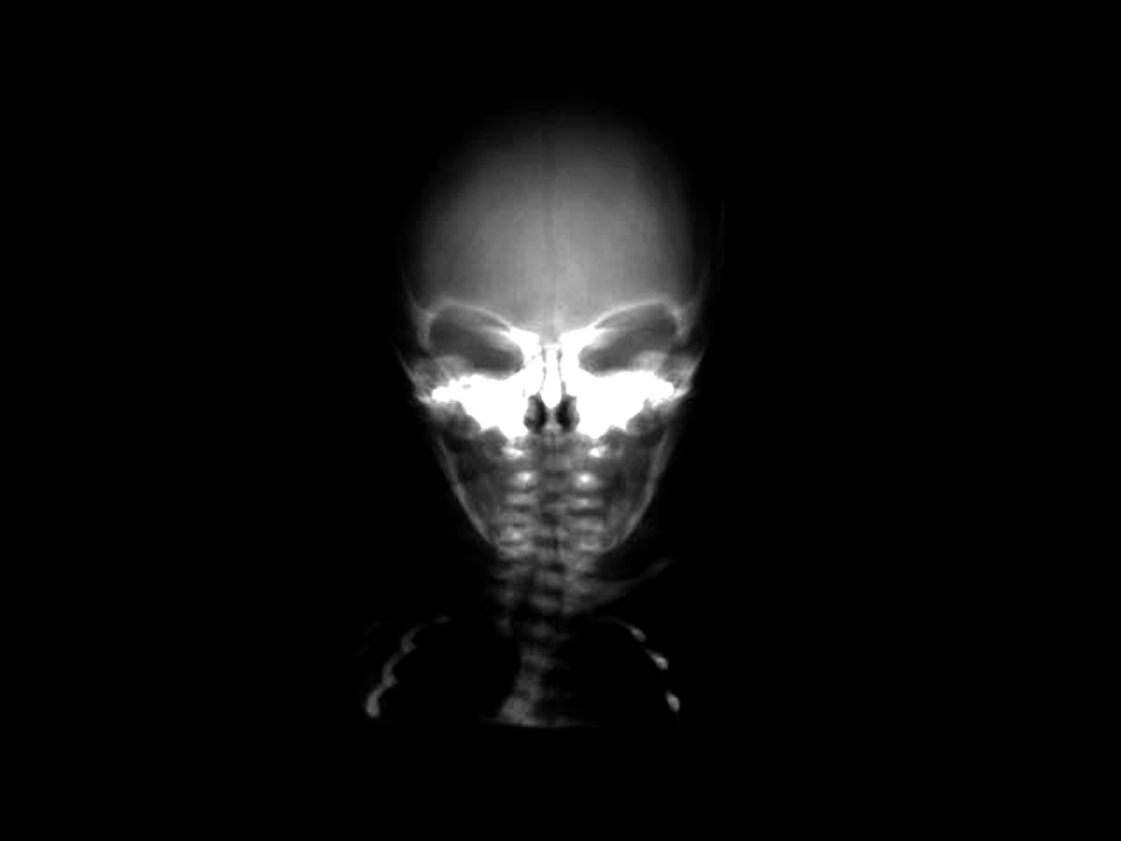 3d обои Рентгеновский снимок  черепа # 88338